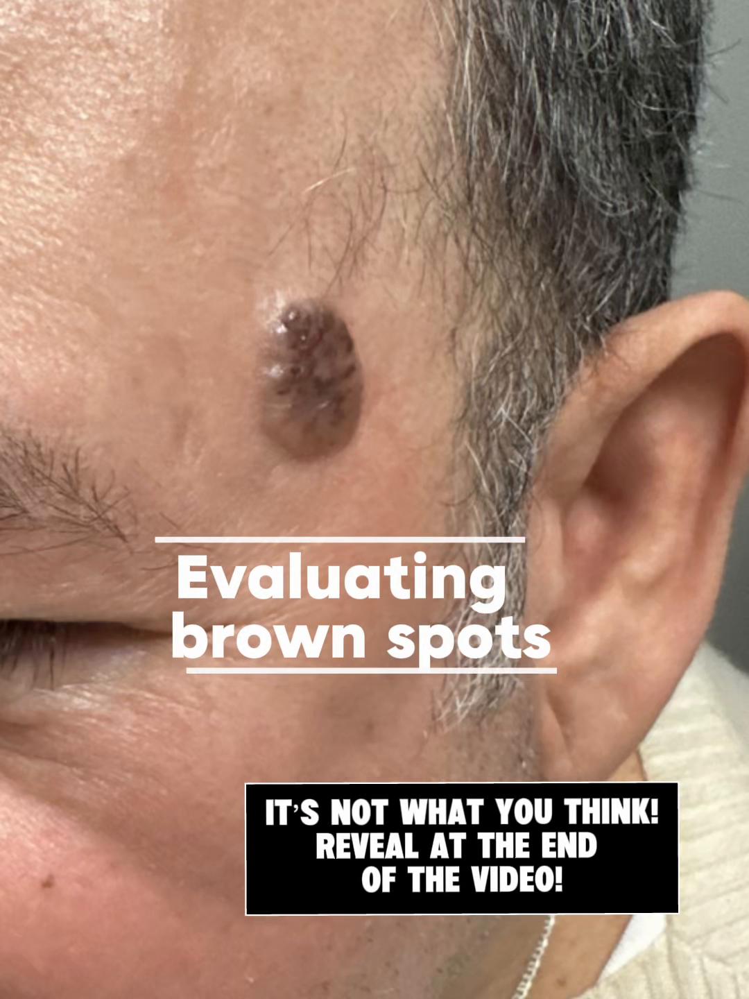 @Rosedermnyc