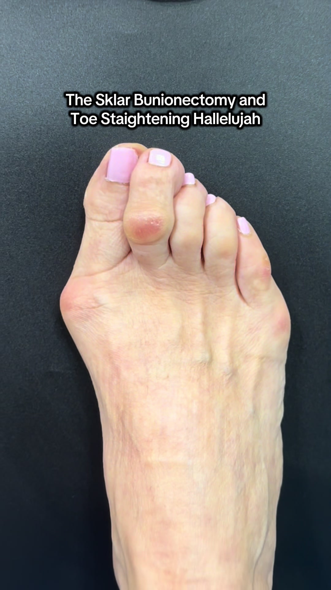 @Foot First Podiatry