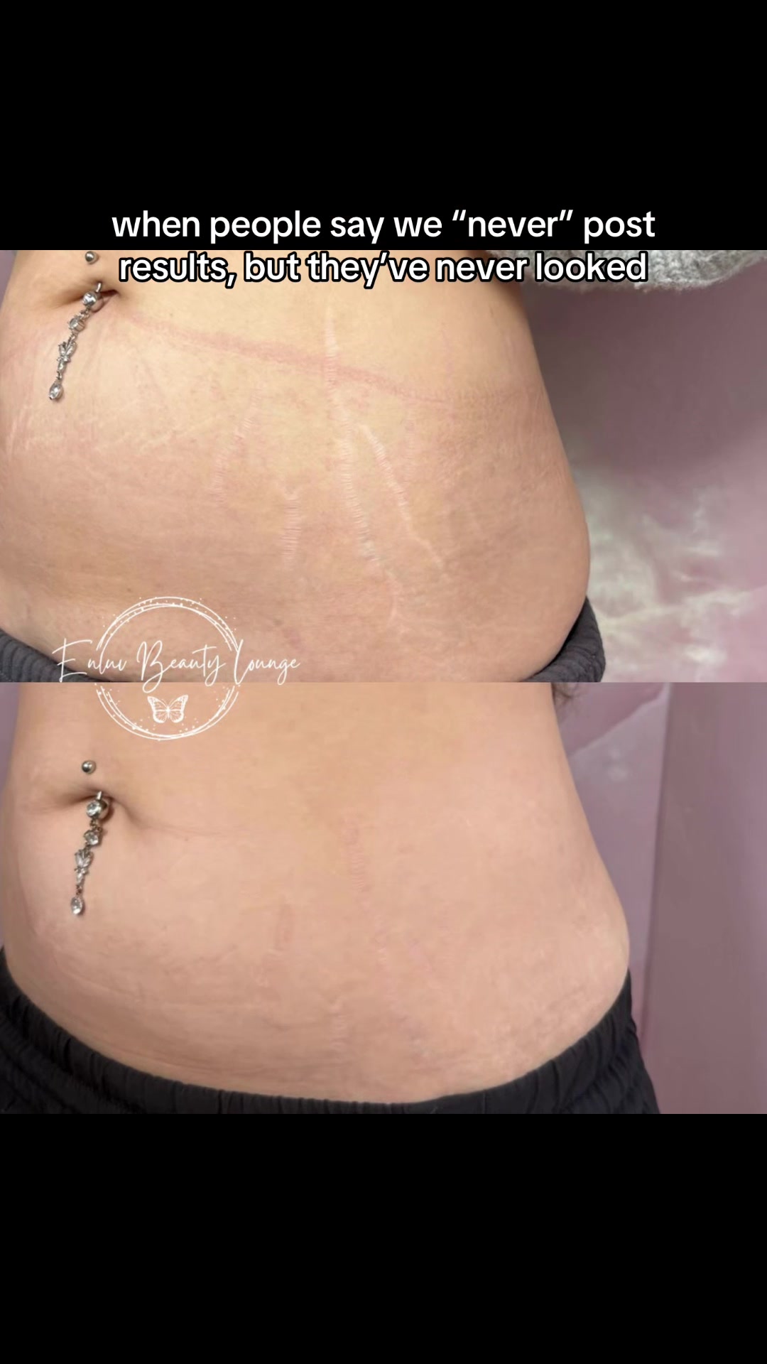 @Stretch Mark Fairy 🧚✨