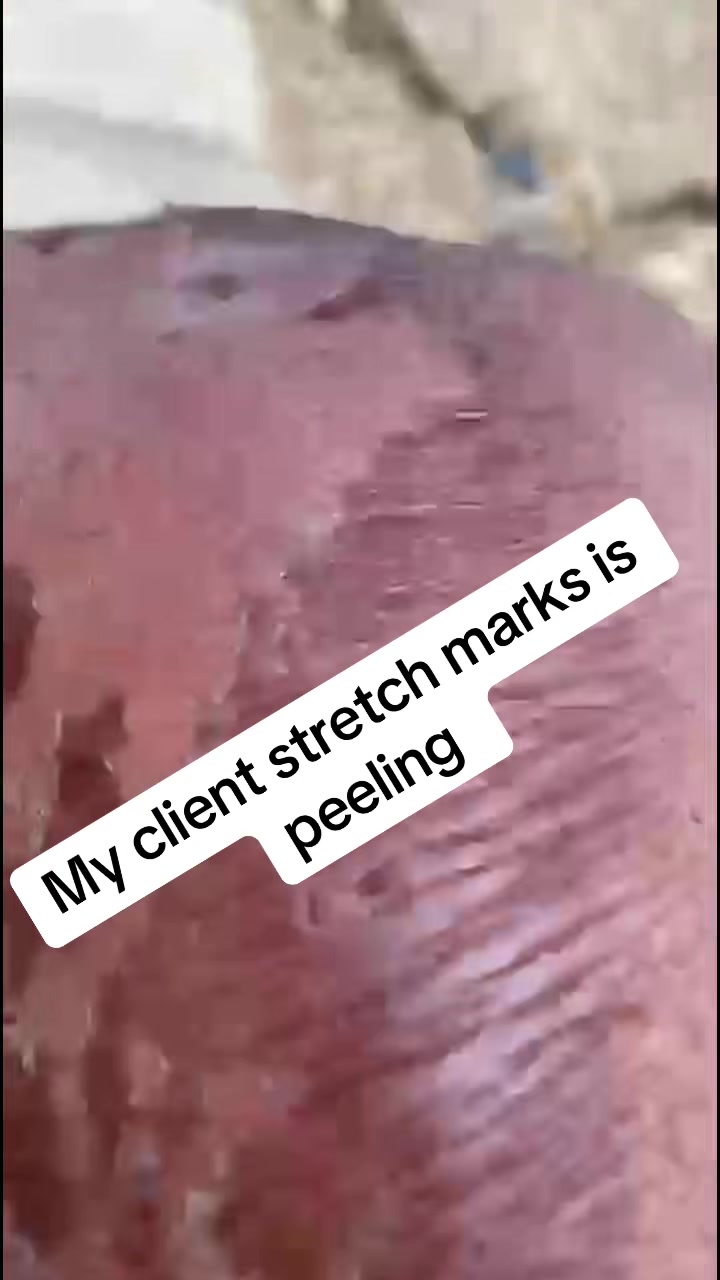 @@ Precious peeling soap