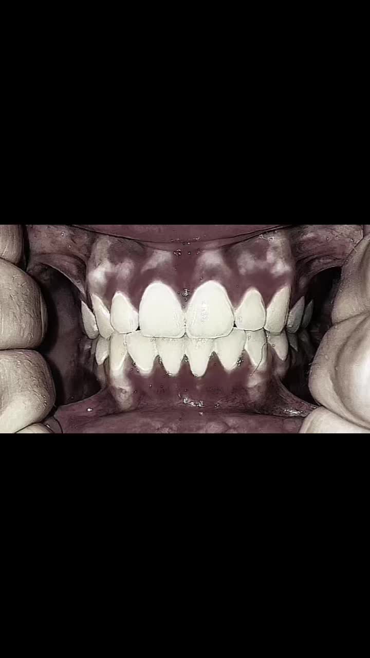@♱𝕸𝖔𝖓𝖘𝖙𝖊𝖗𝖗♱