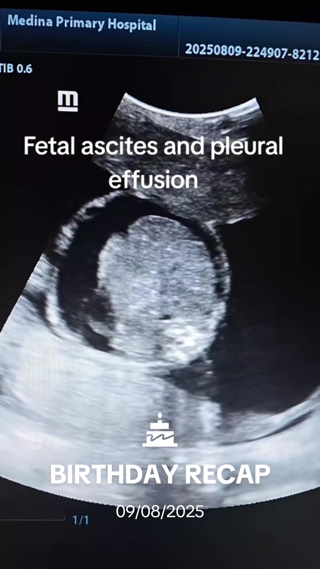@Dr Wubie Endalew(Radiologist)