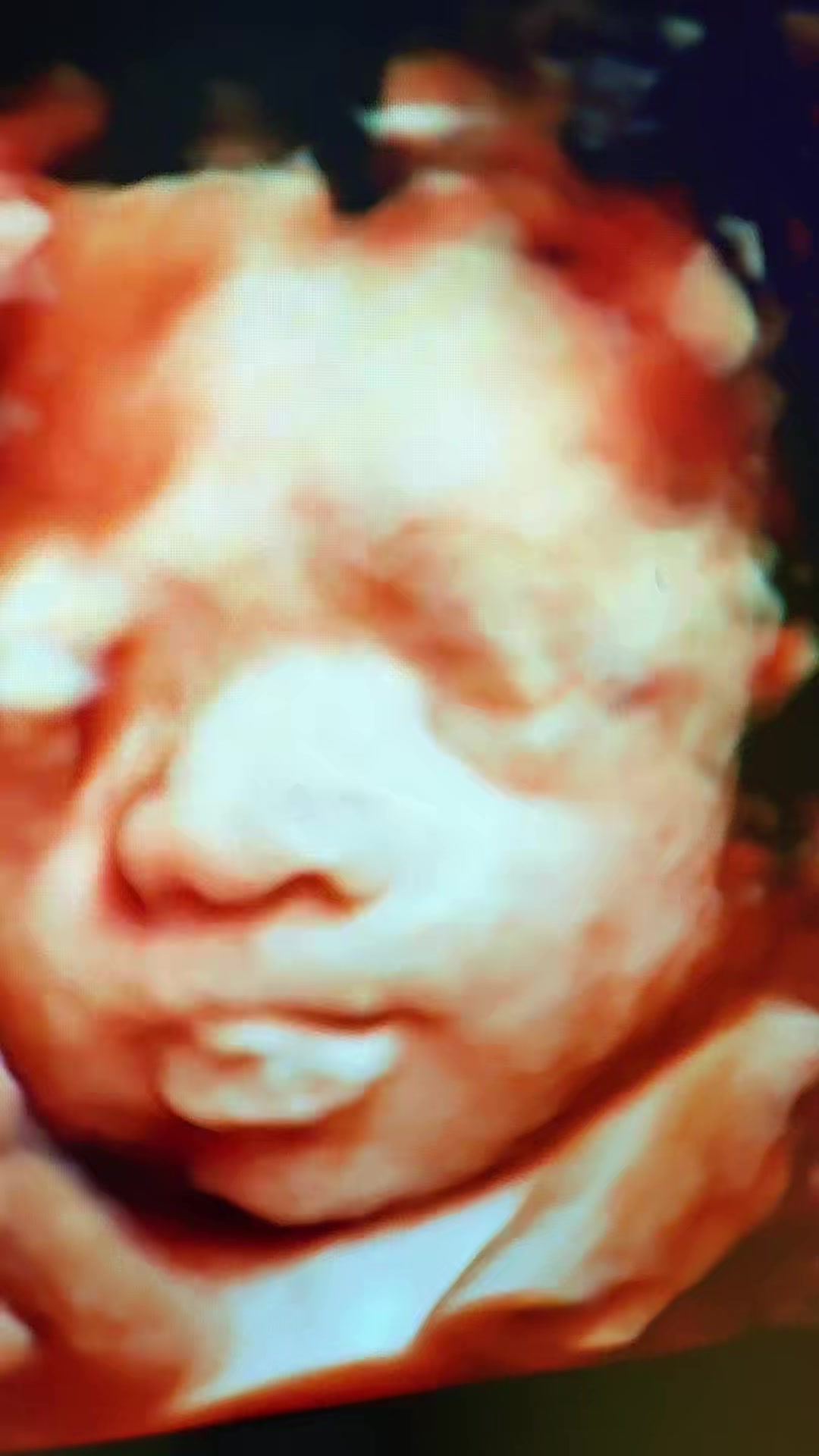 @PregnantSee Inc.