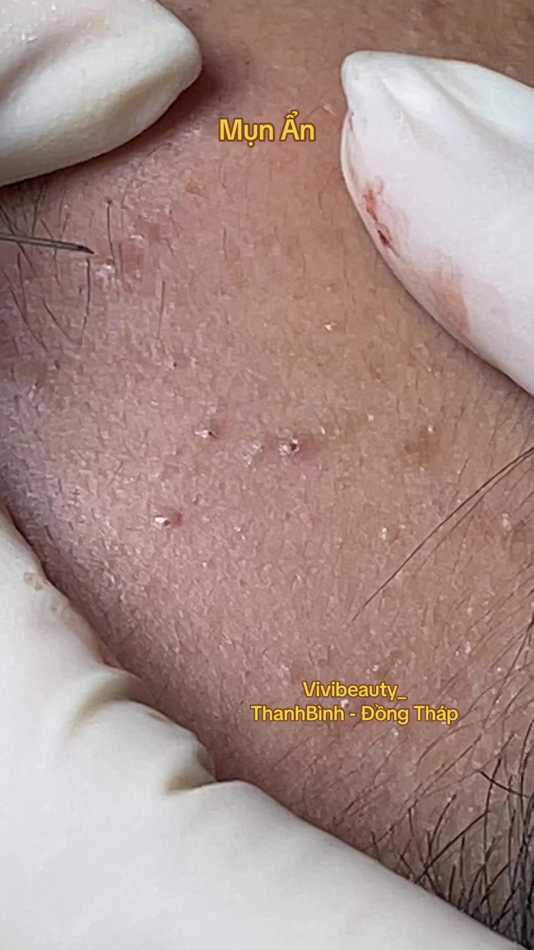 @Phượng Vi (ViViBeauty)
