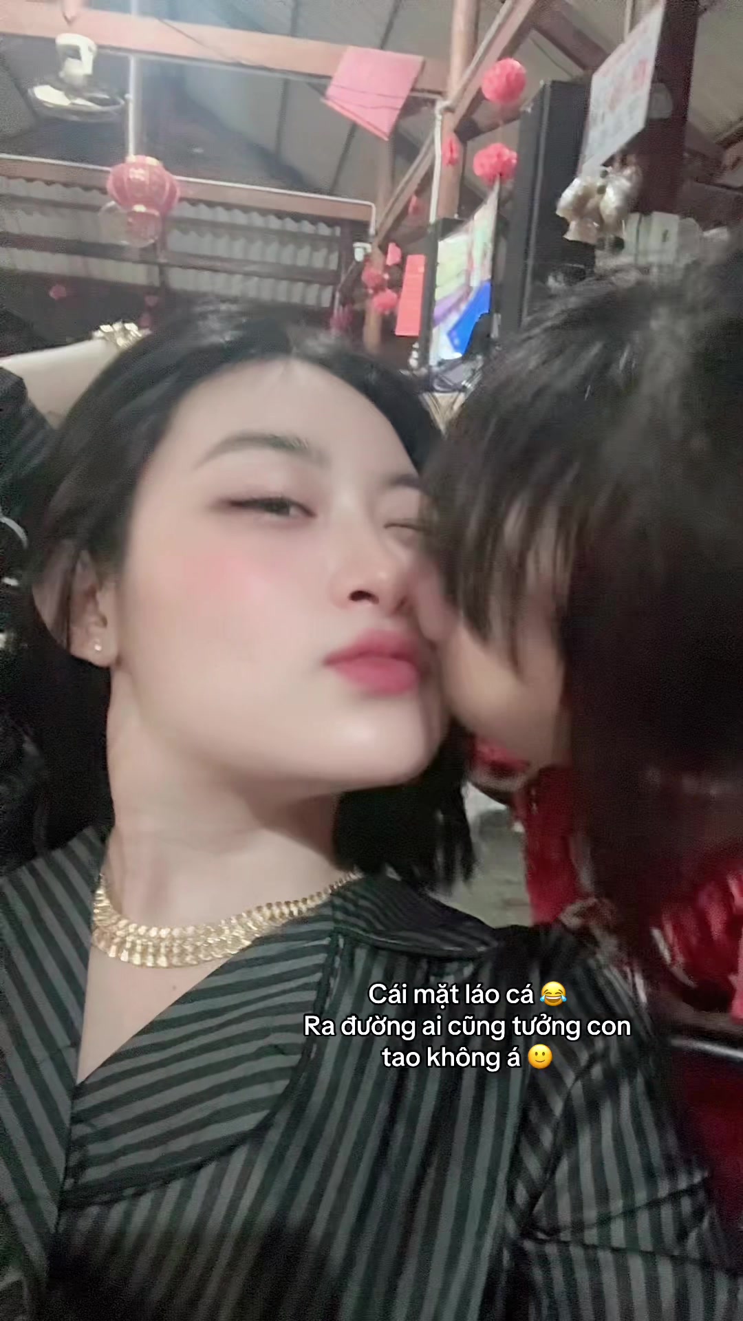 @TRẦN TRANG FILLER BÌNH THUẬN💉