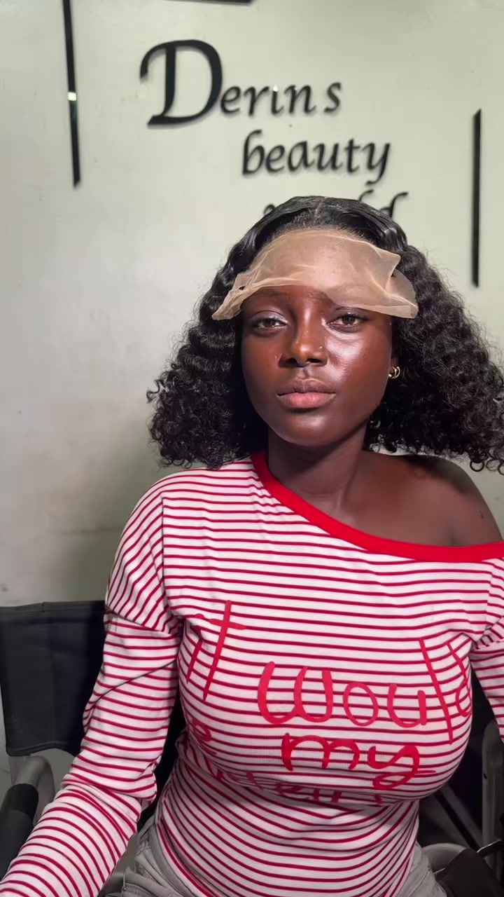 @Thevitiligogirl