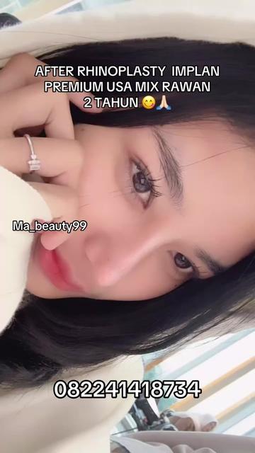 @MA BEAUTY 99