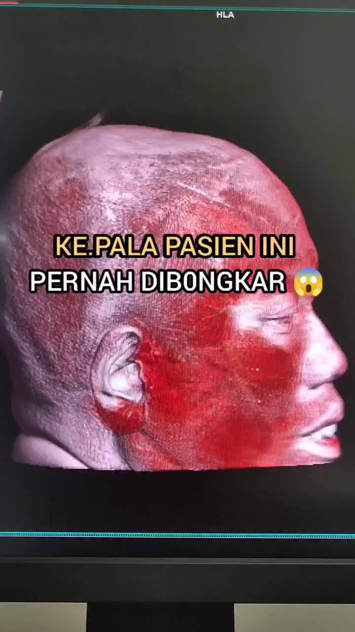 @Sobat Radiology