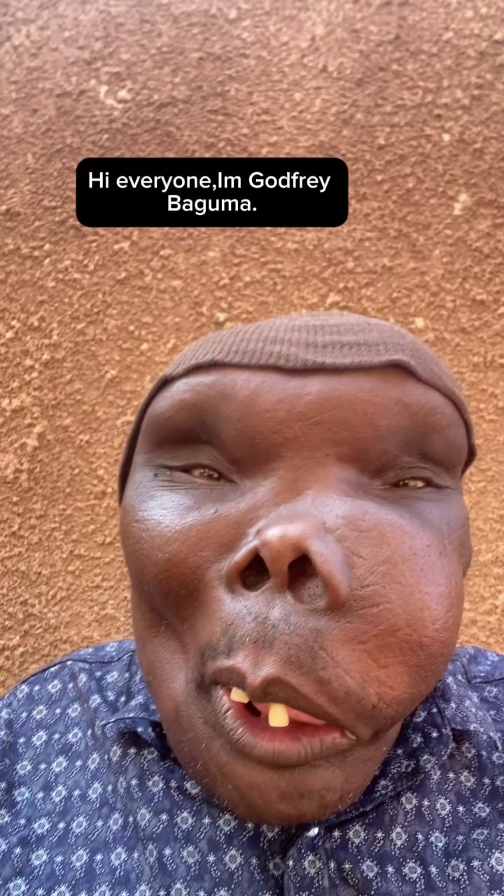 @Baguma Godfrey