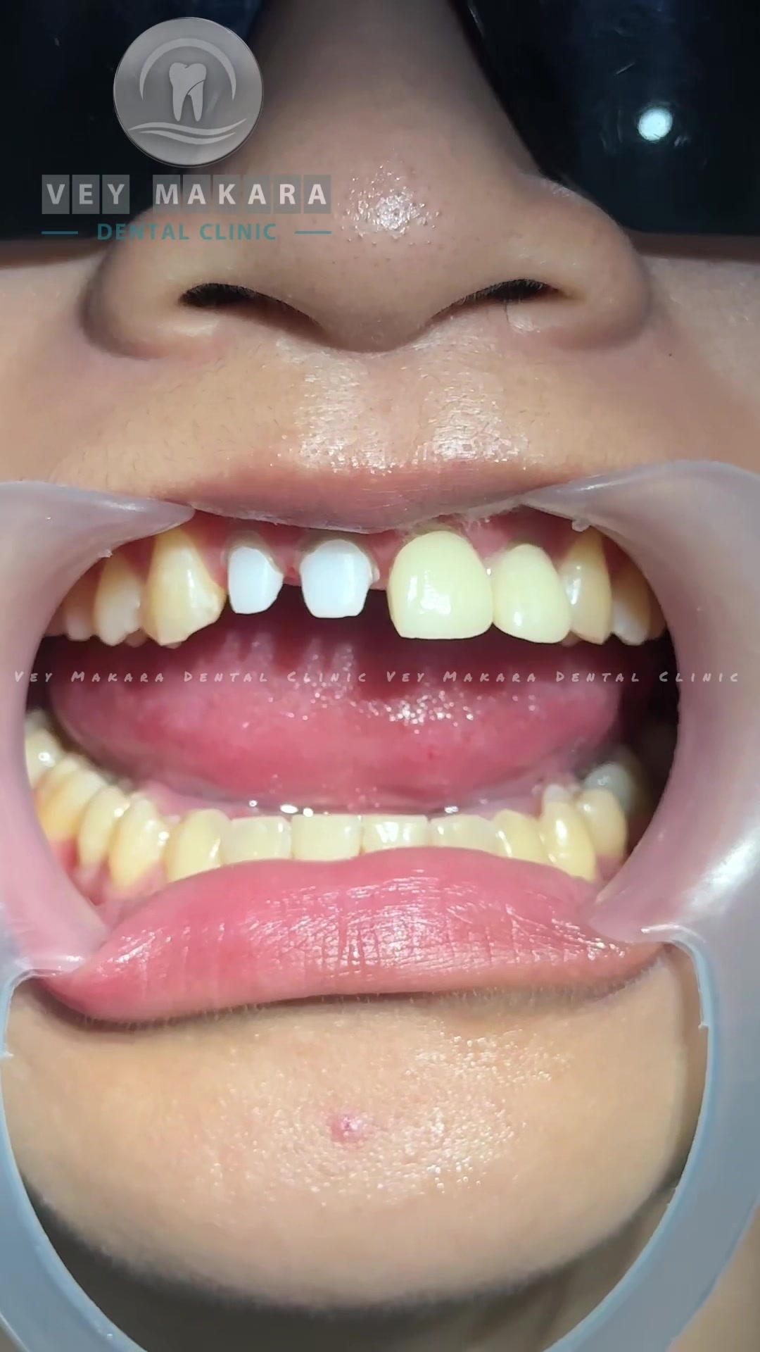 @គ្លីនិកធ្មេញវ័យមករា