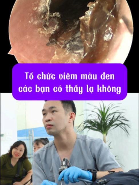 @Bs Hiệu Tai Mũi Họng Long Bi&ecirc;n