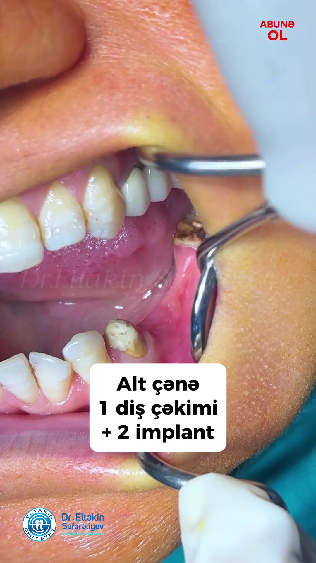 @eltakindentistry