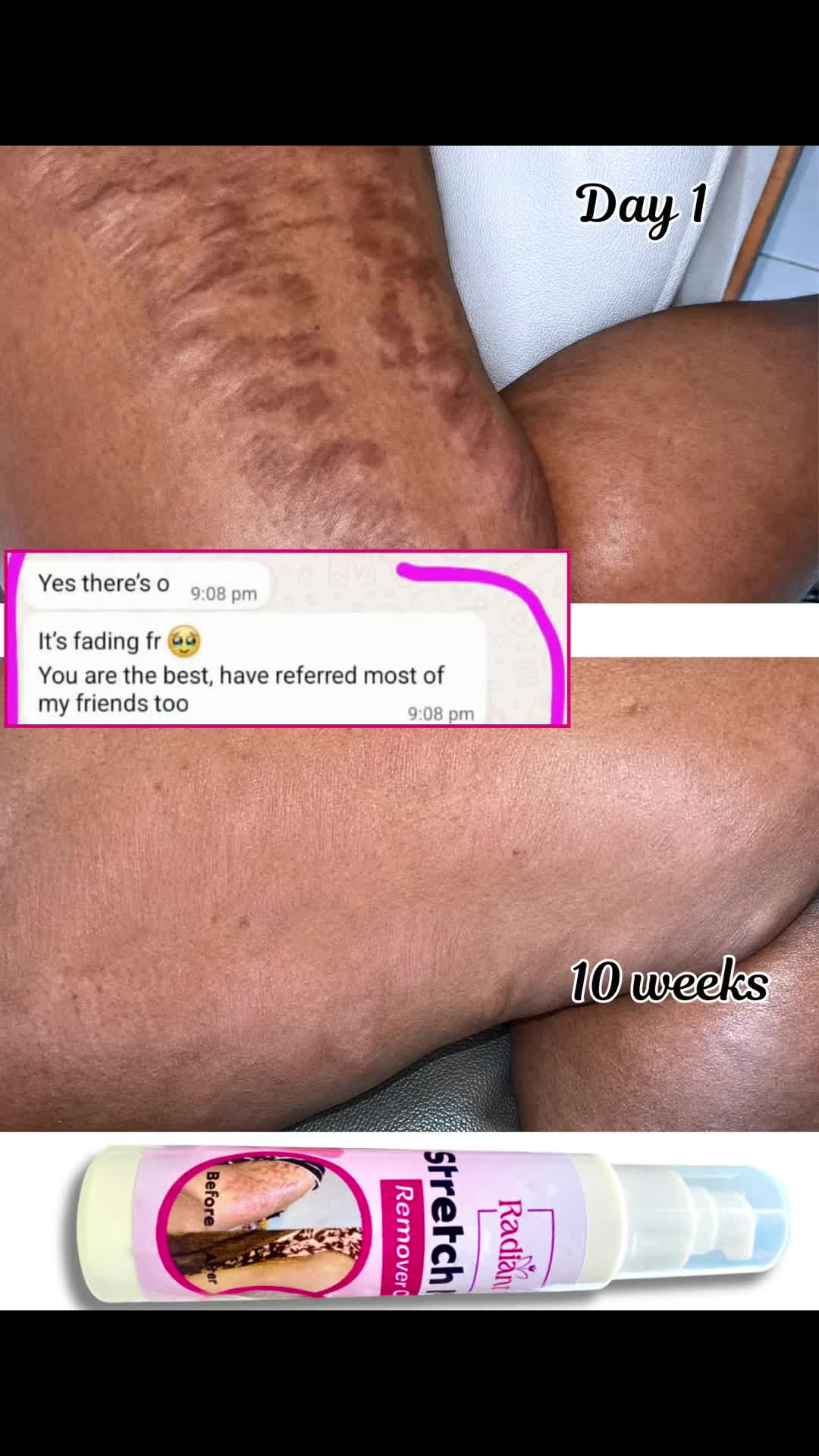 @Radiant skin