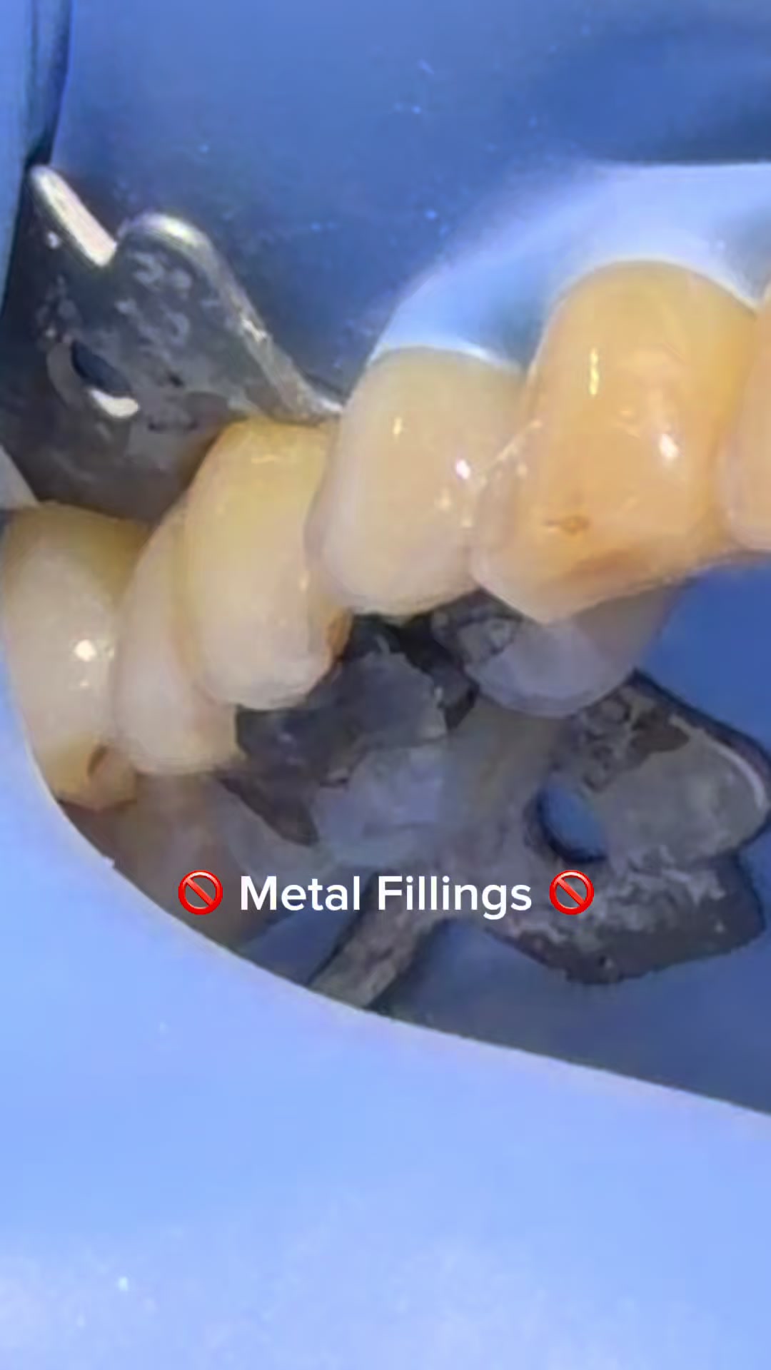 @Hello Dental