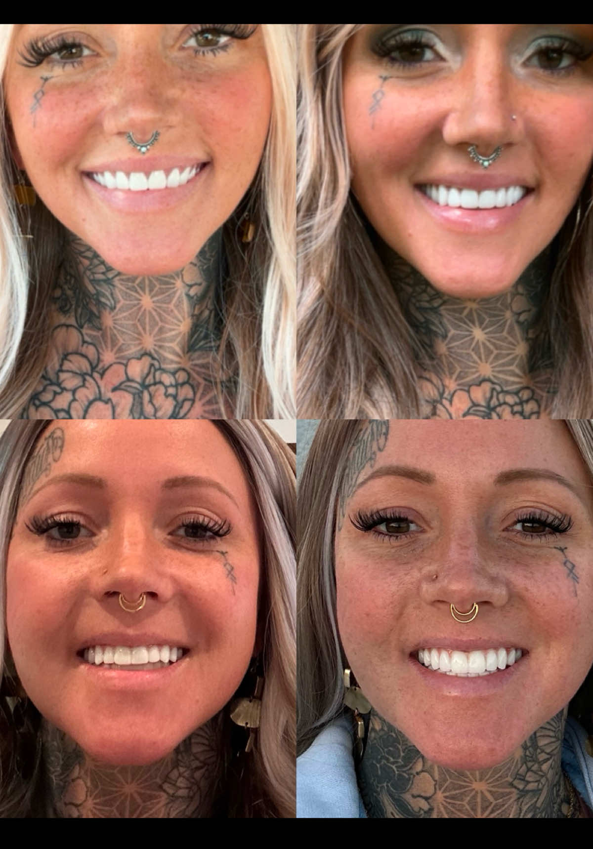 @denturegirly OG