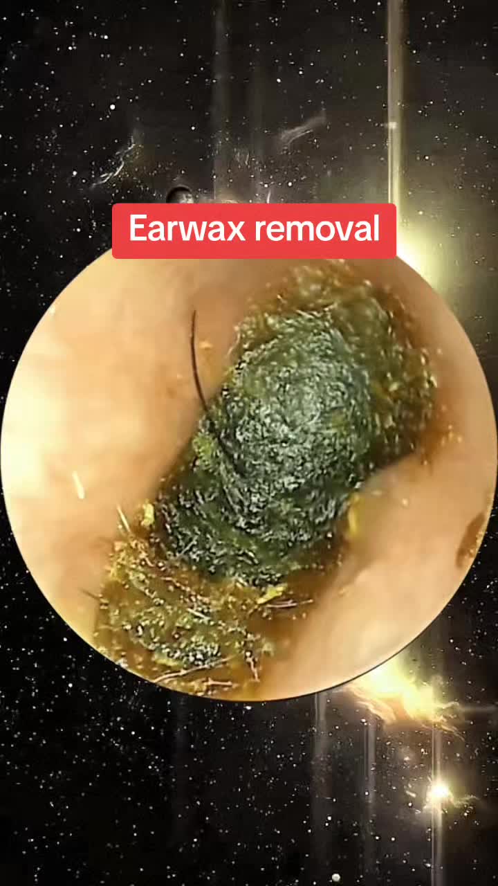 @Earwax.pro