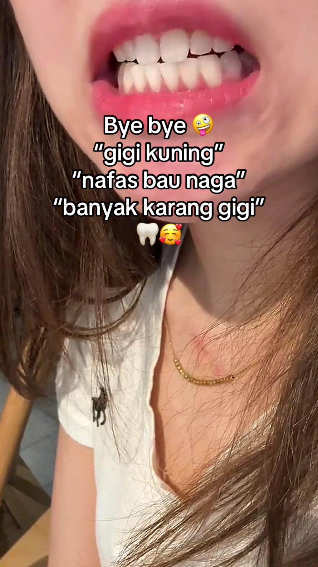 @Gigi Putih Berkilau🦷✨
