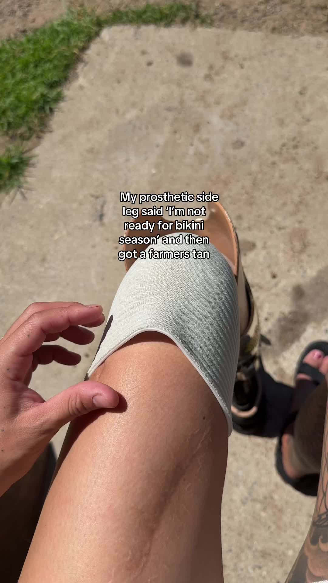 @noleg_noproblem