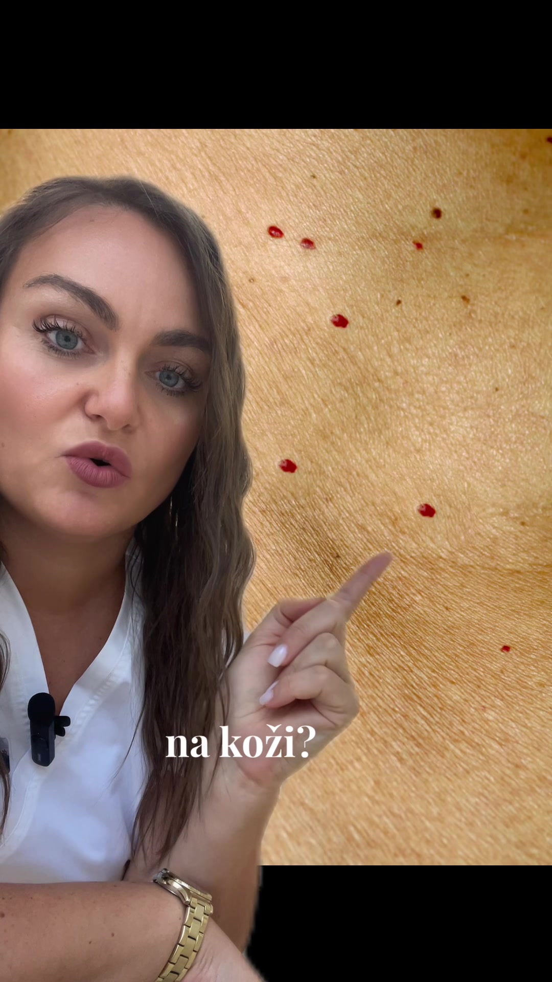@DivaLaserCentar