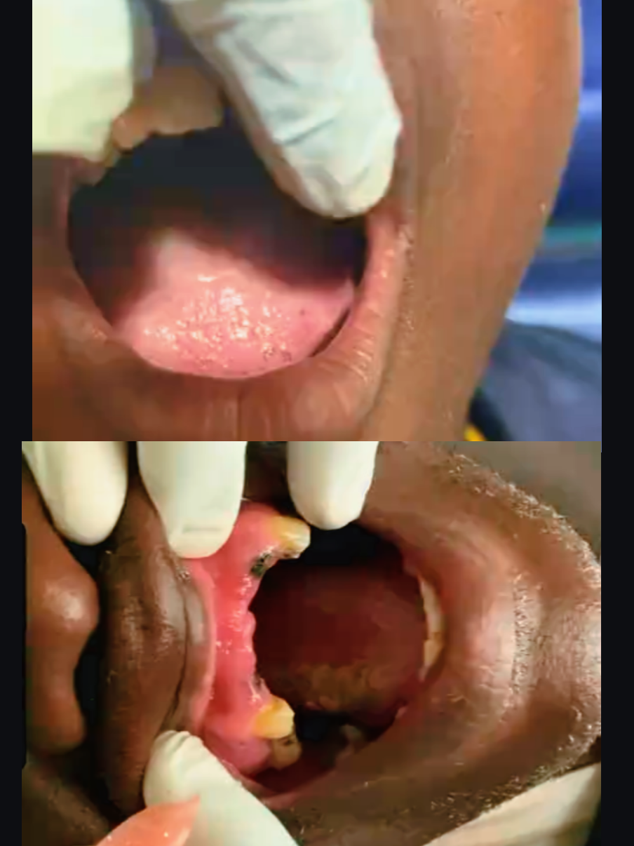 @@KAI Dentalcare123kampala