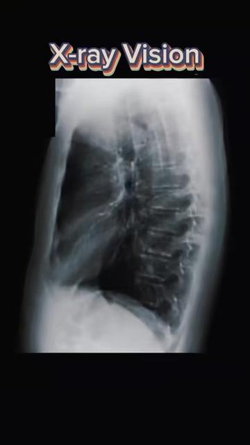 @the radiology zone
