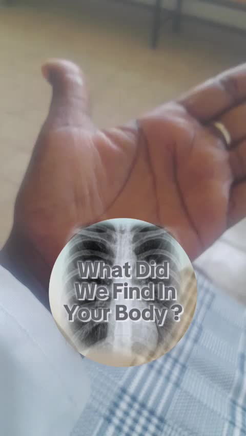 @Tewubeshal kinfe