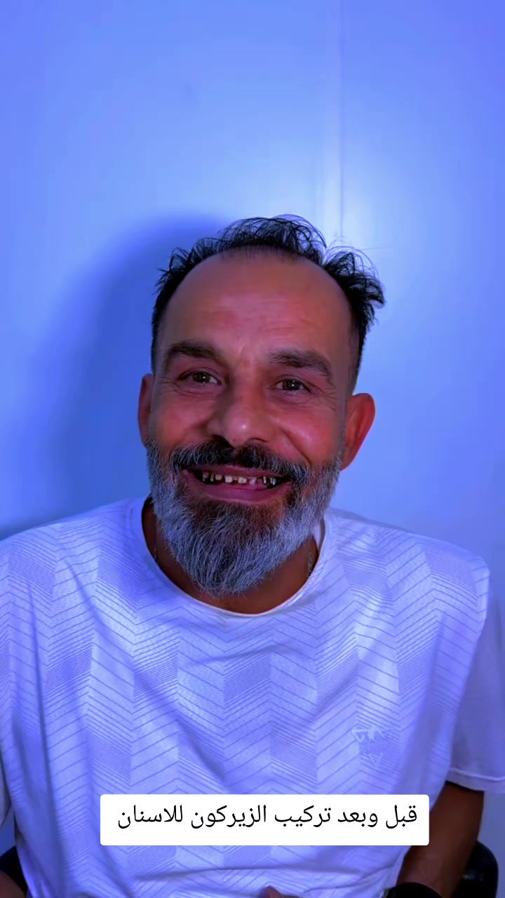 @Dr mohammad