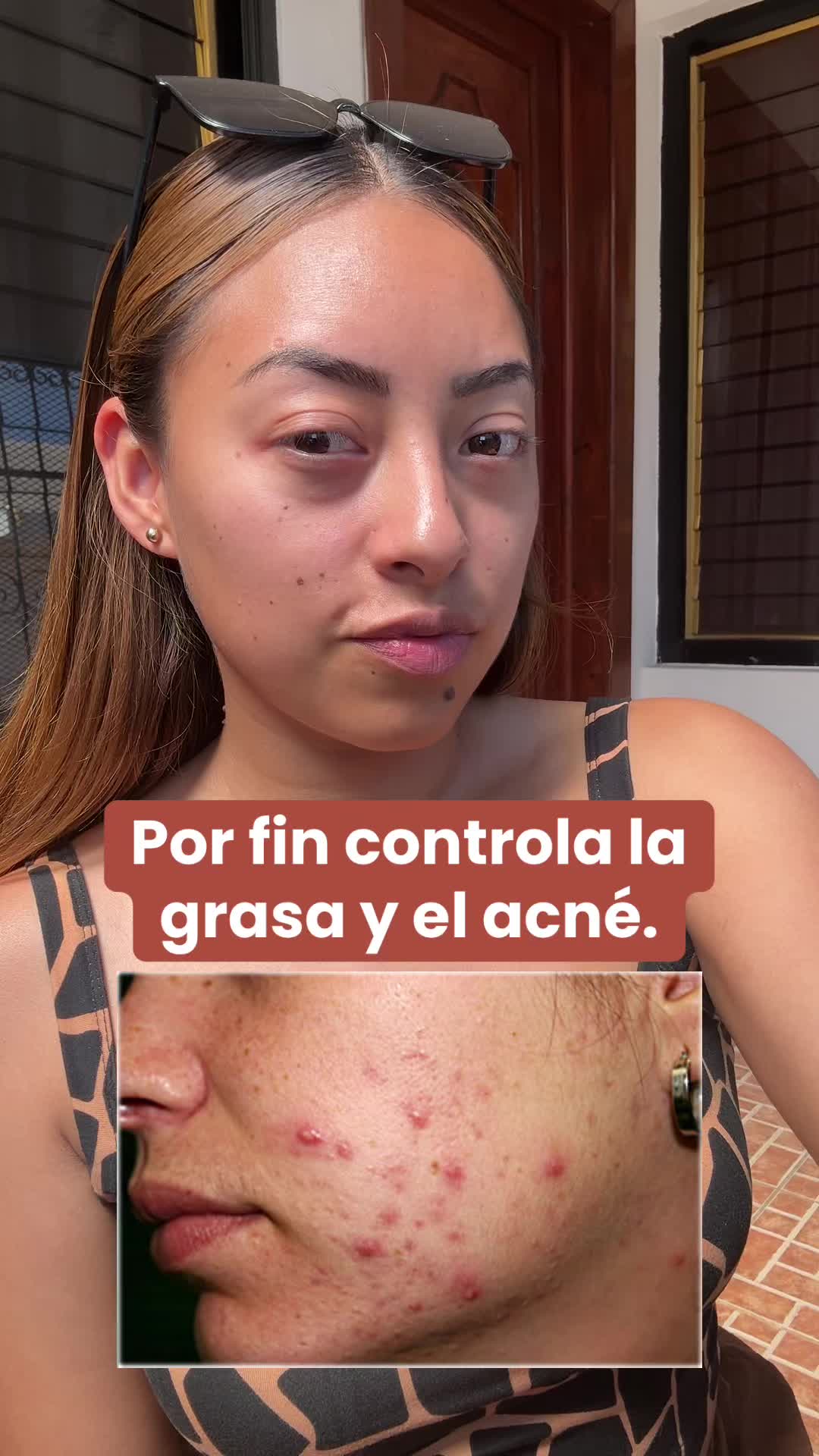 @Aylin Hiralda