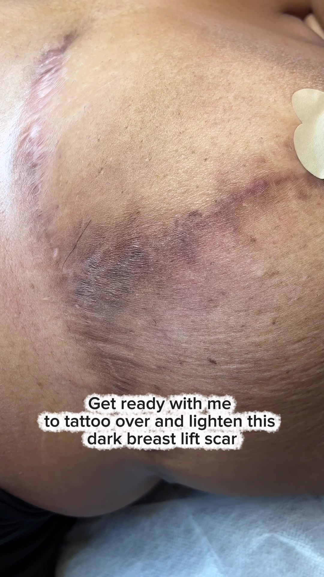@Invisibleskinhelp