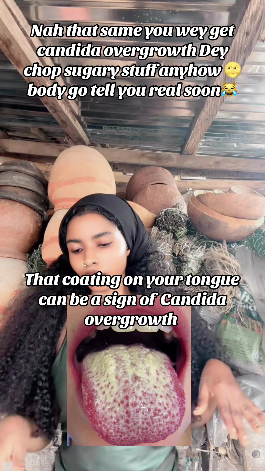 @GeNz_alagbo🐍🍯