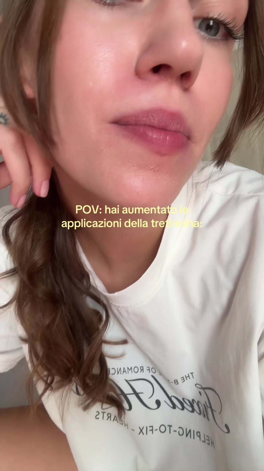 @Diana