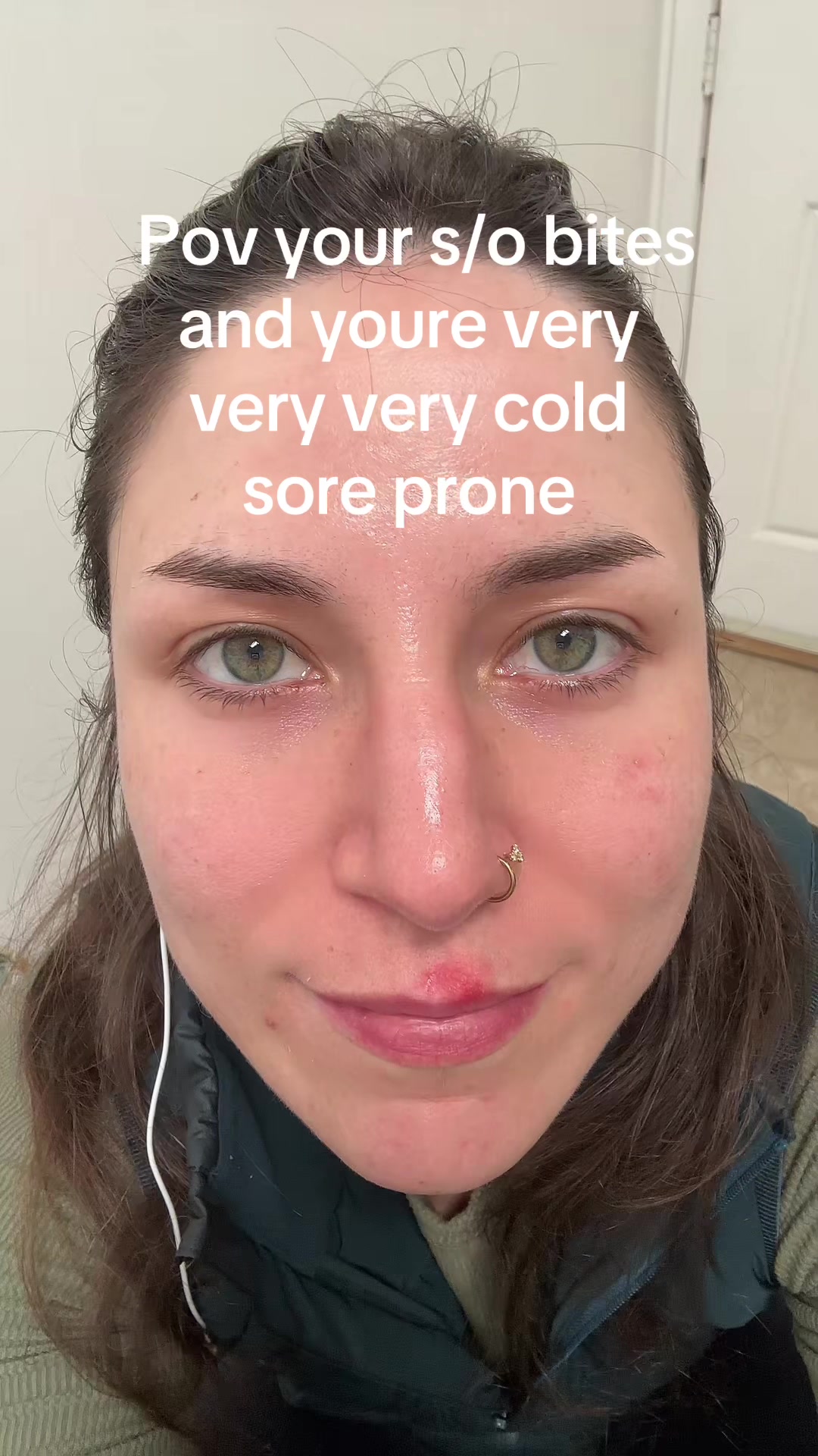 @Fruitgoop