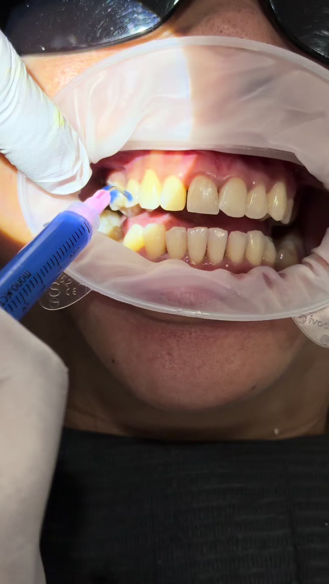 @Hello Dental