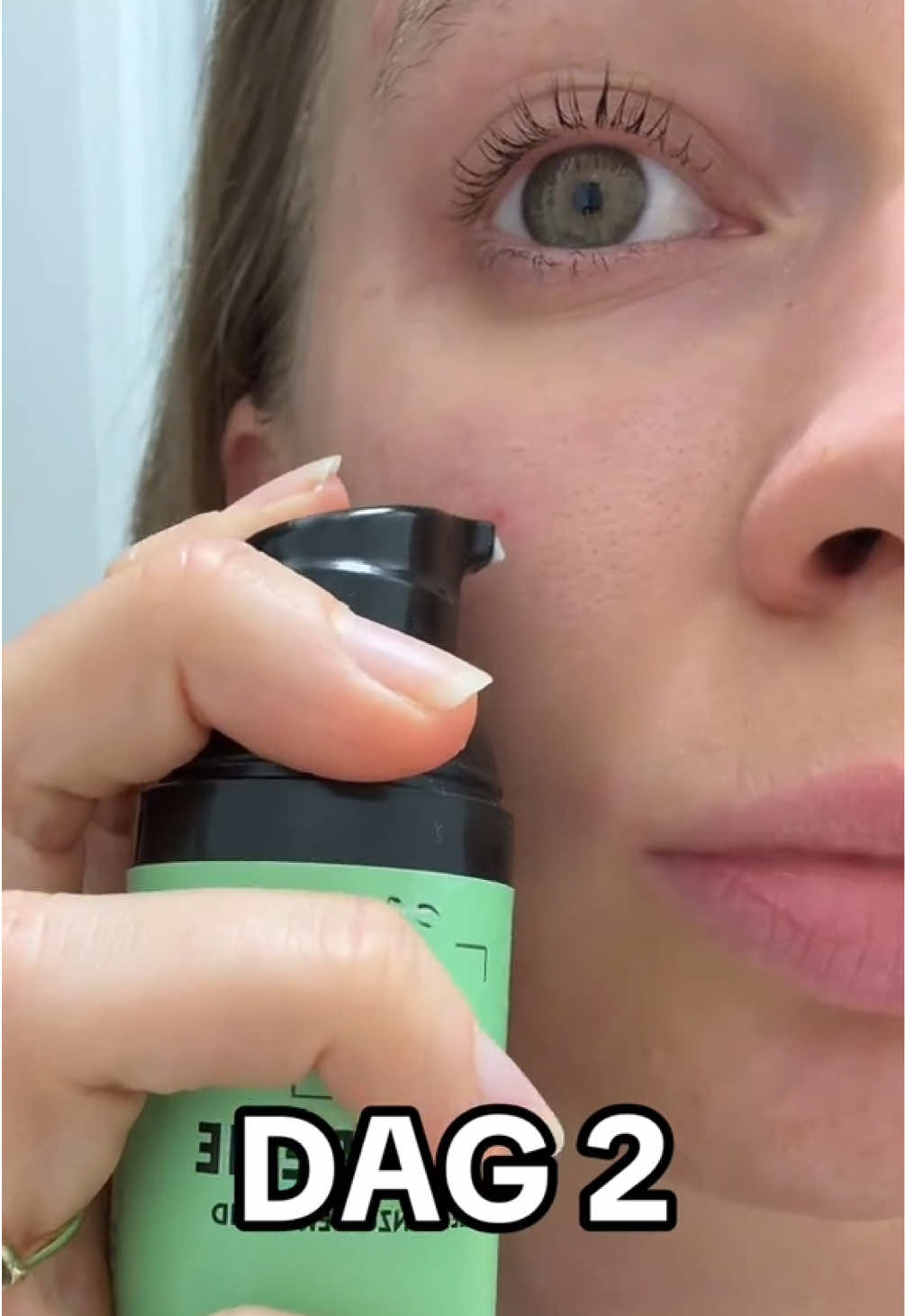 @Skinfixer