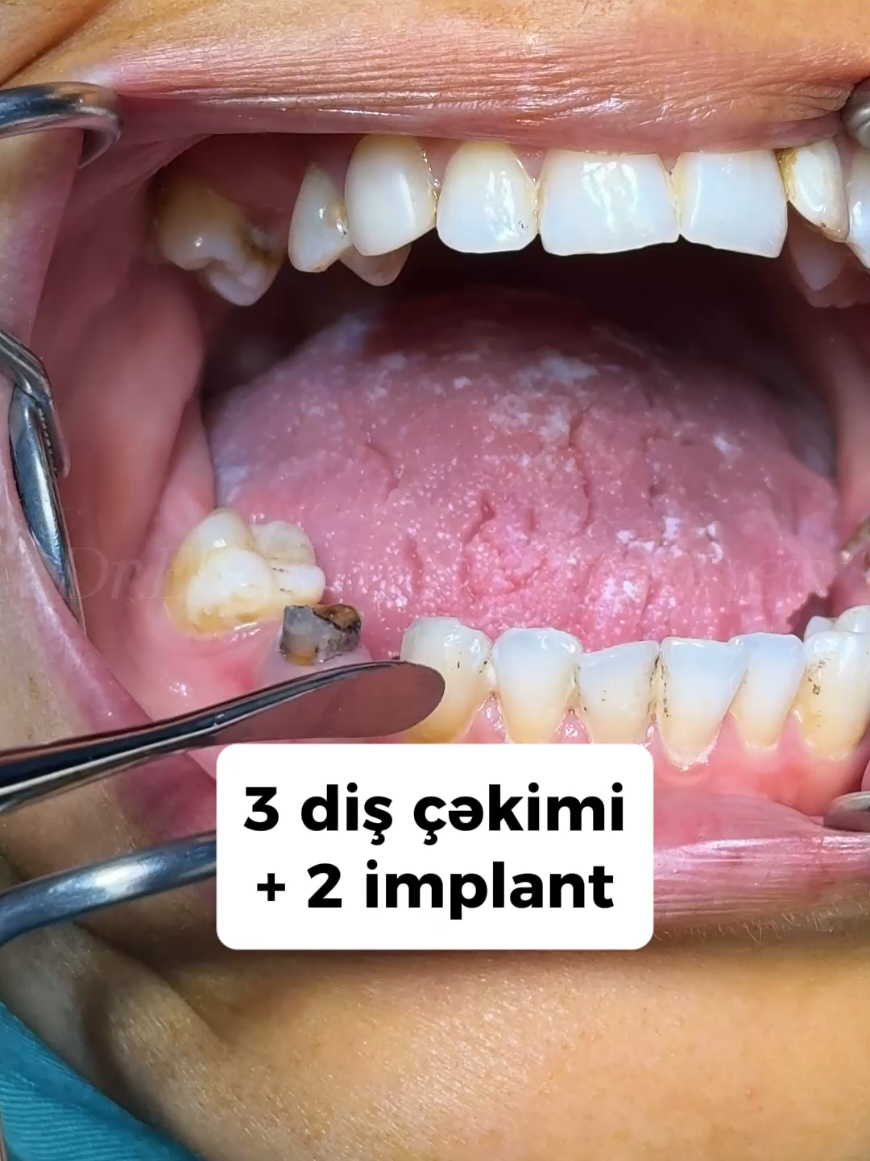 @eltakindentistry