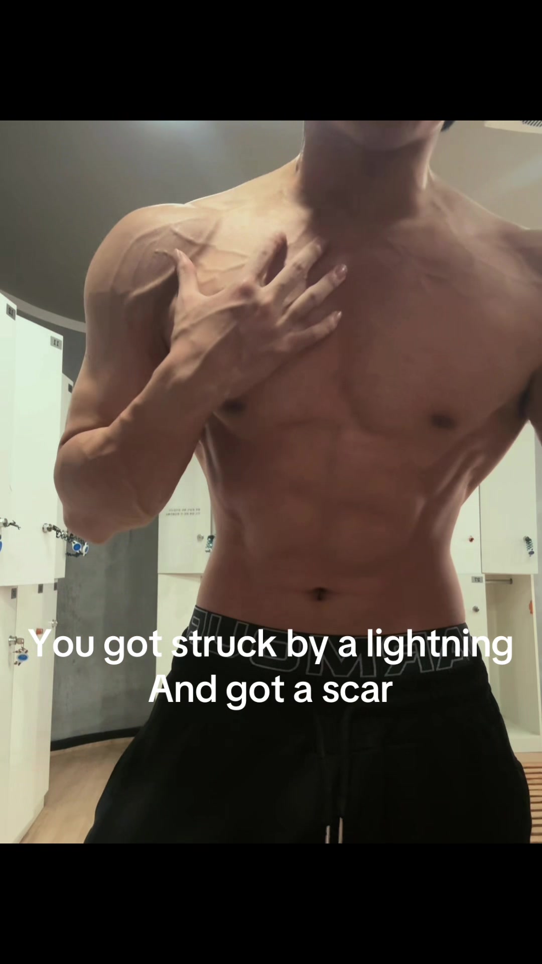 @VINTRX