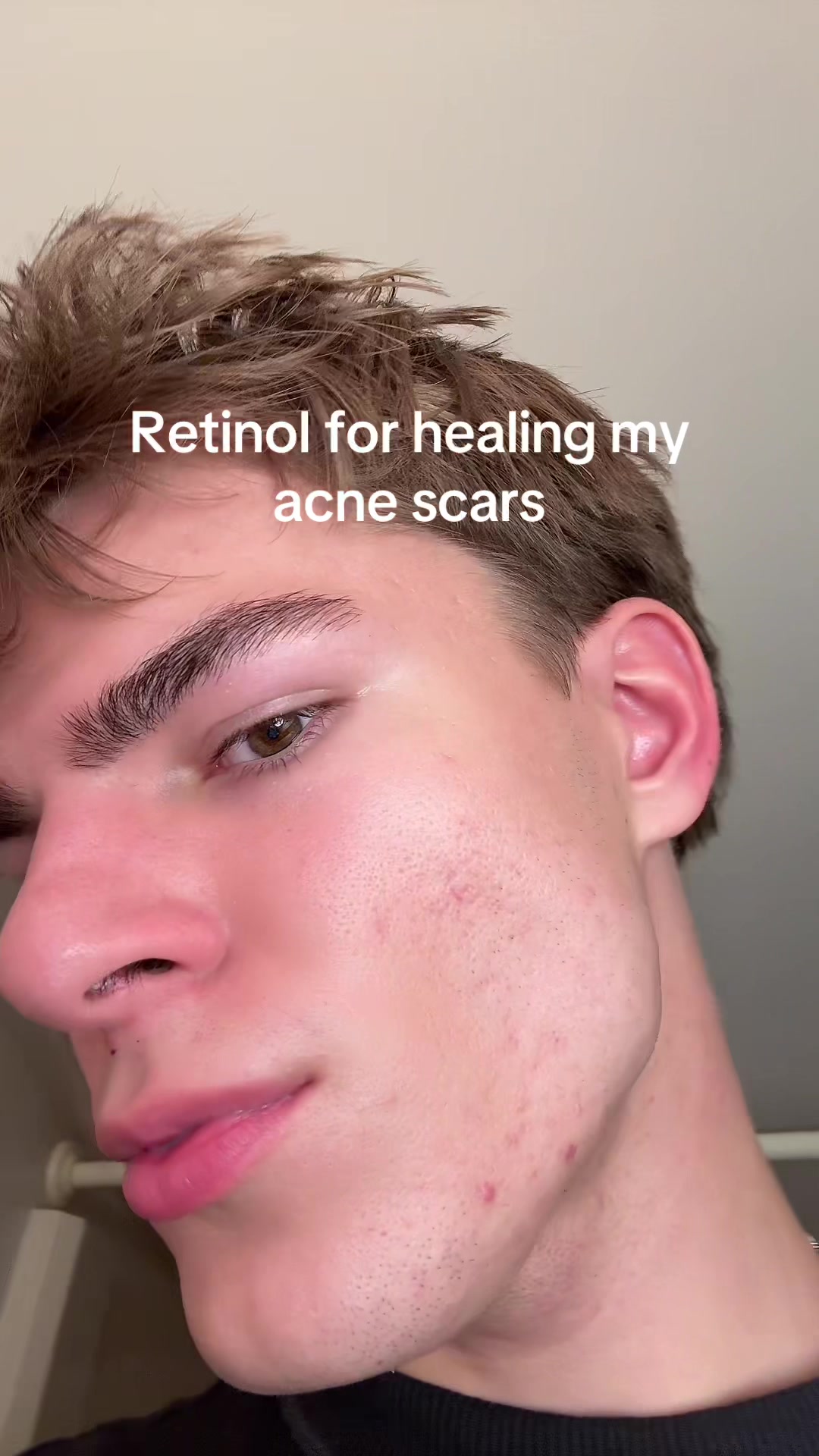 @Finn