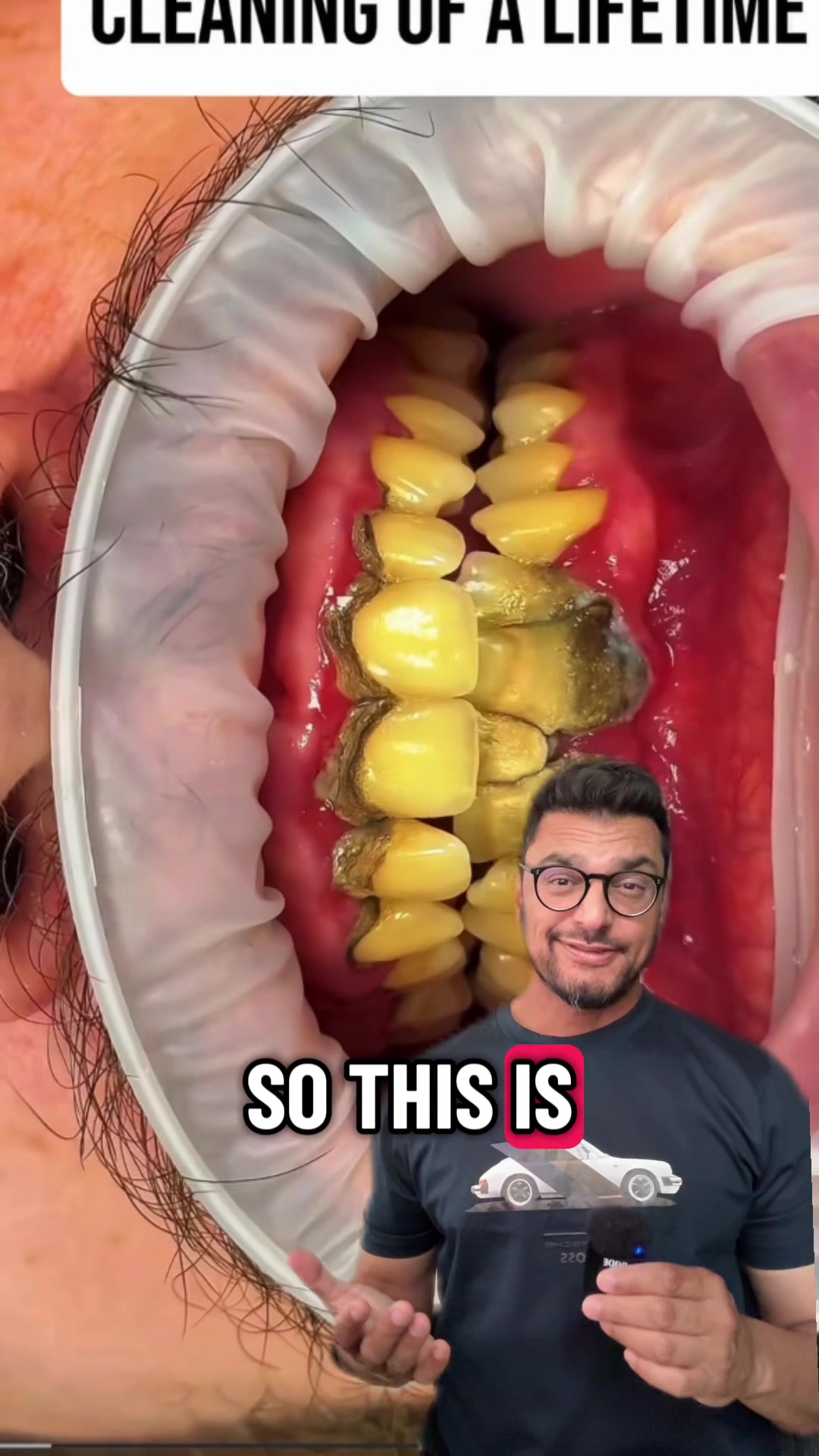 @Dentite