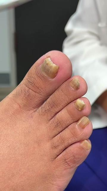 @Deniel Foot and Ankle Center