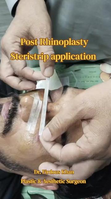 @Dr Firdous Khan PlasticSurgeon