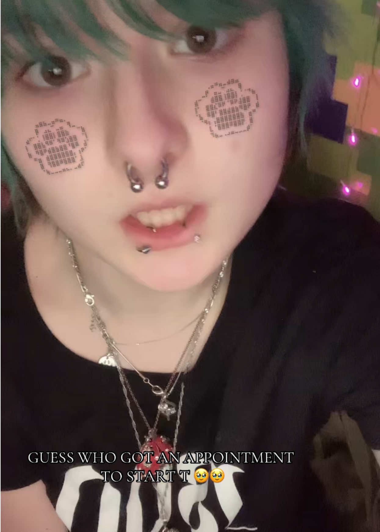@🐾 RAY!! &times;_X ⚞&bull;⚟ 🦴