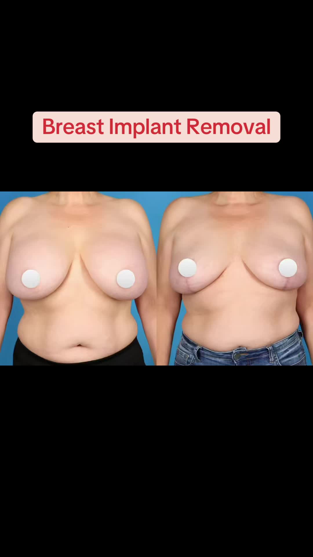 @Kelly&ensp;Killeen,&ensp;MD,&ensp;FACS