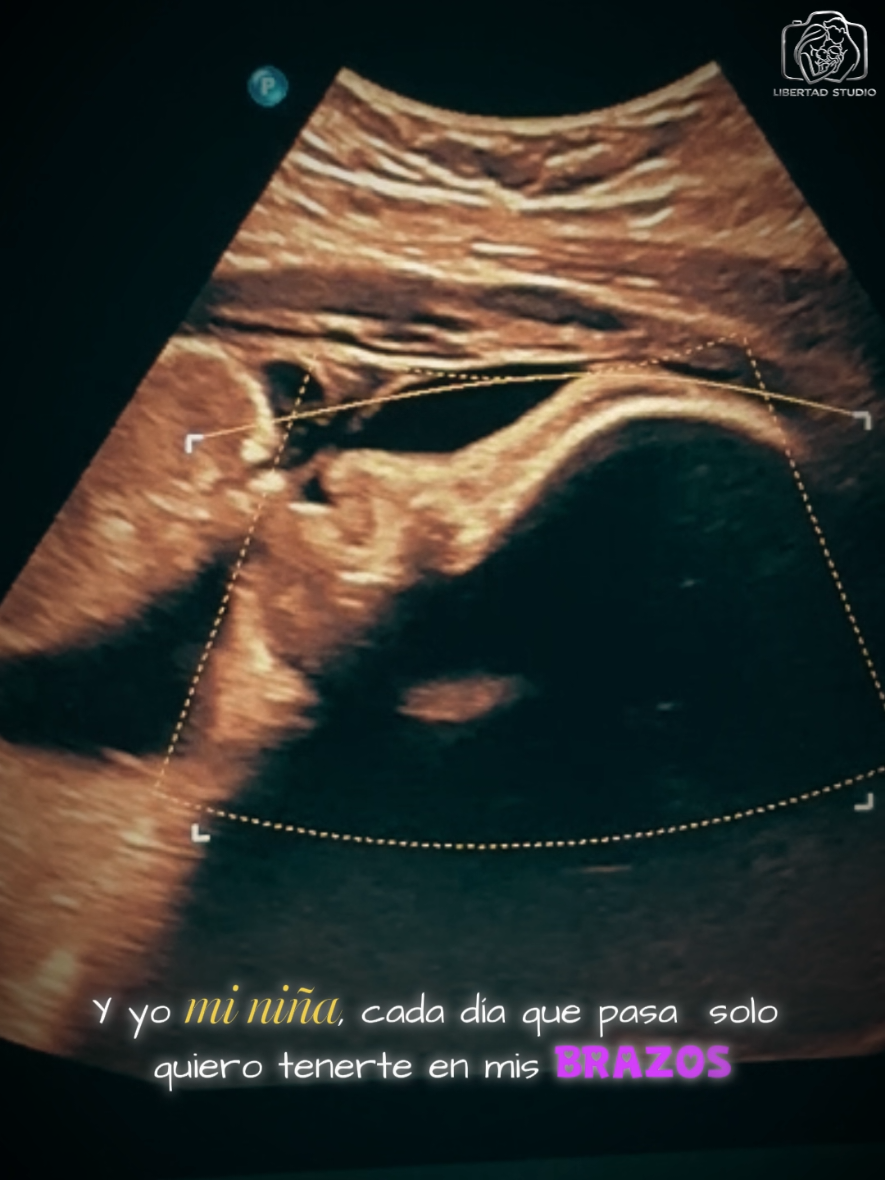@ECOGRAFIAS LIBERTAD 8K