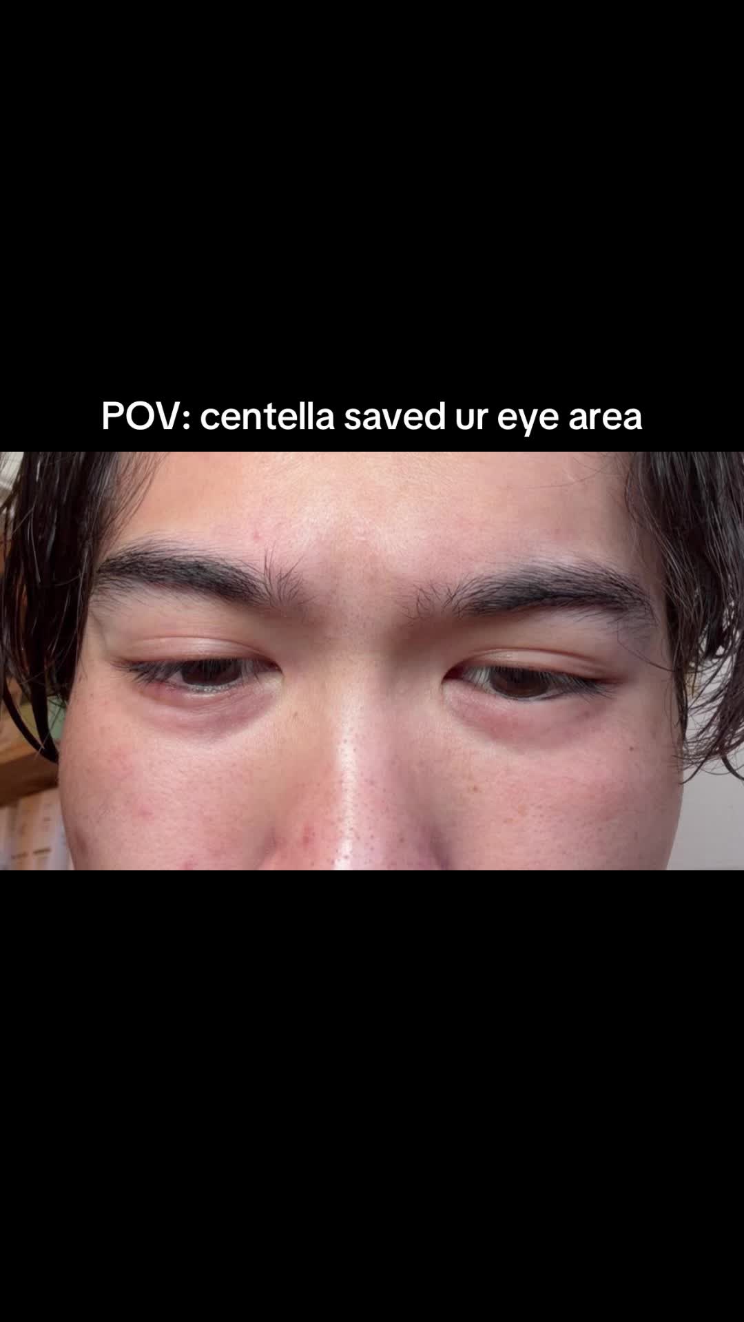 @detected