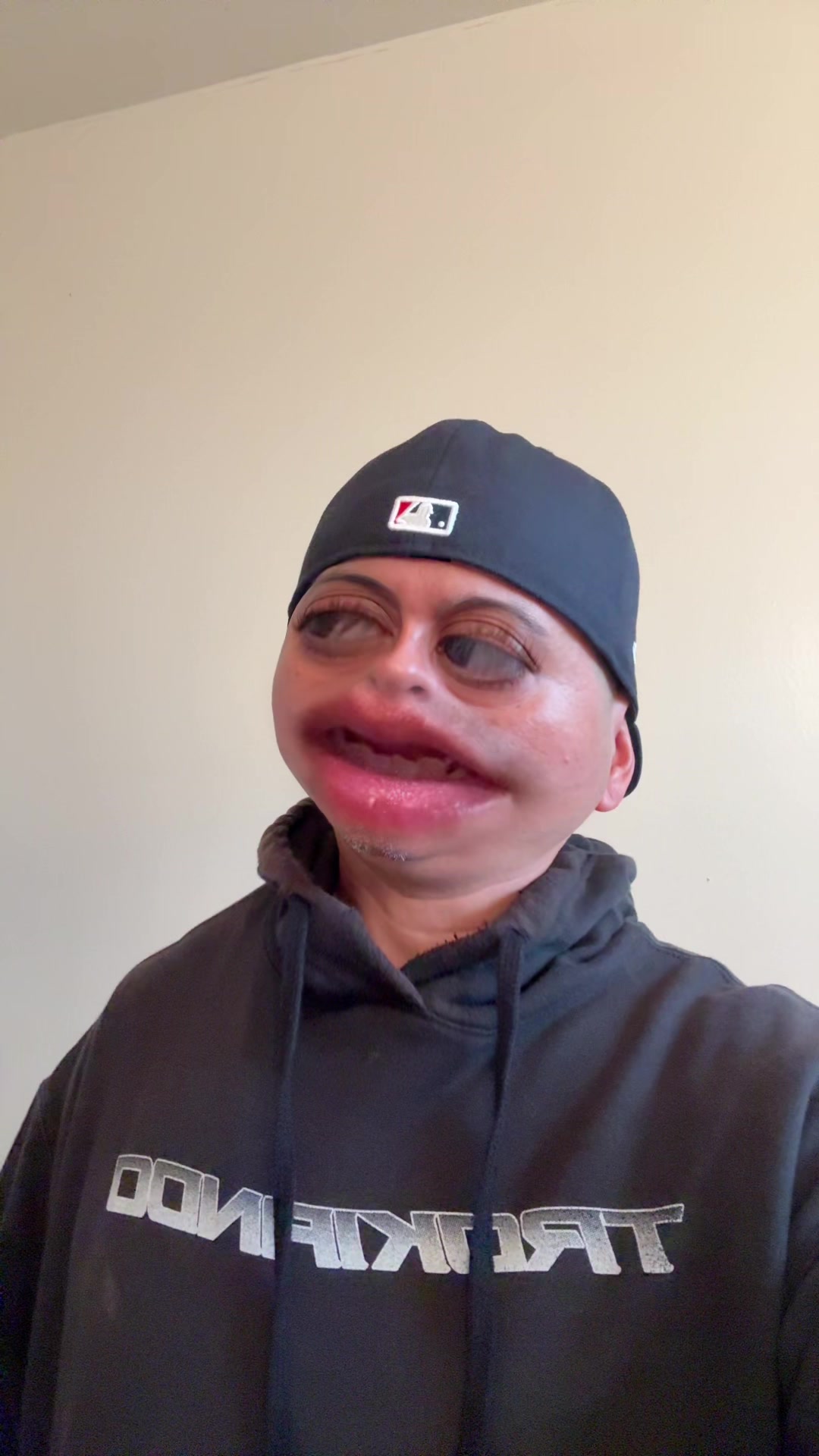 @MP