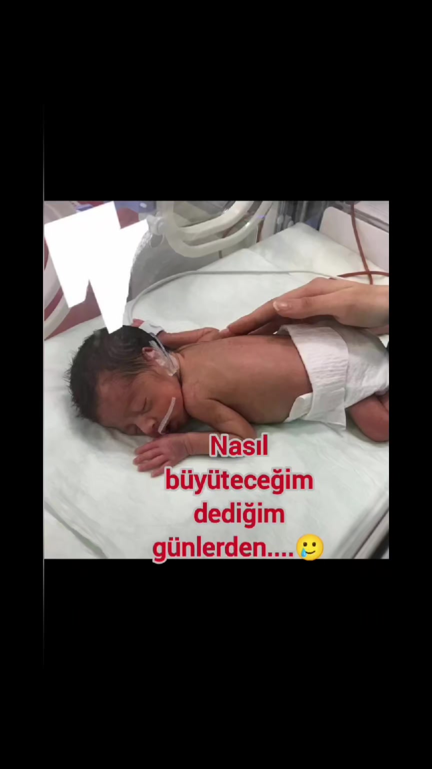 @Hümeyra