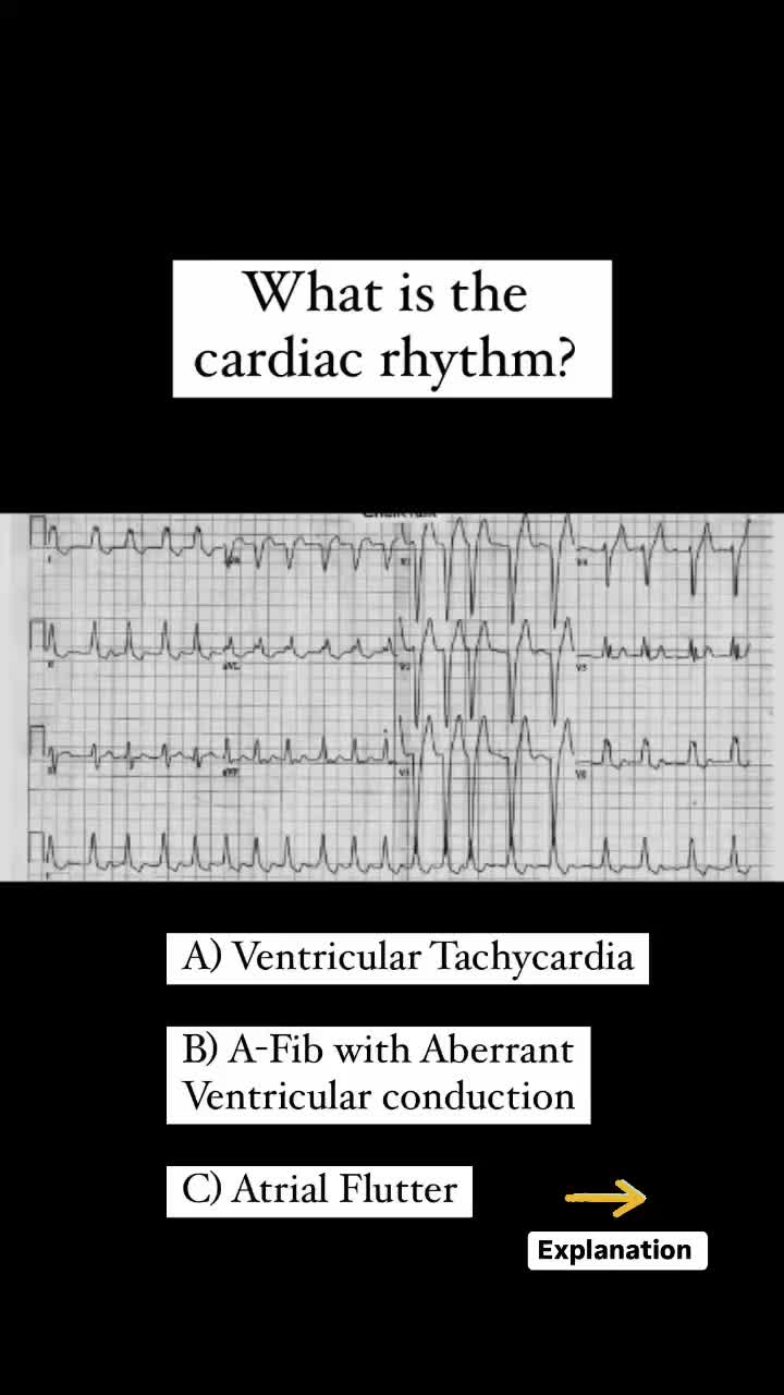 @HandsOnHeart