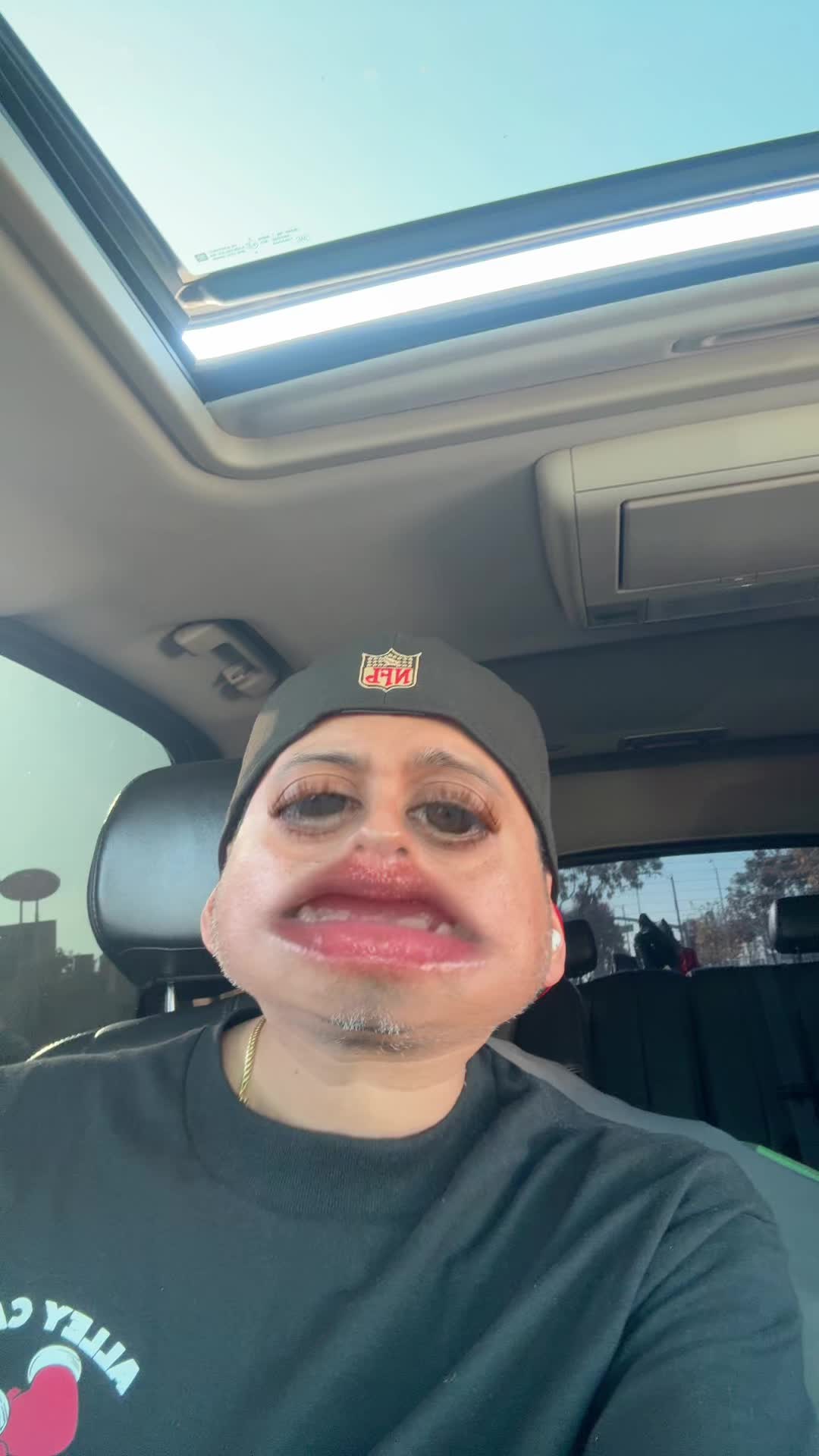 @MP