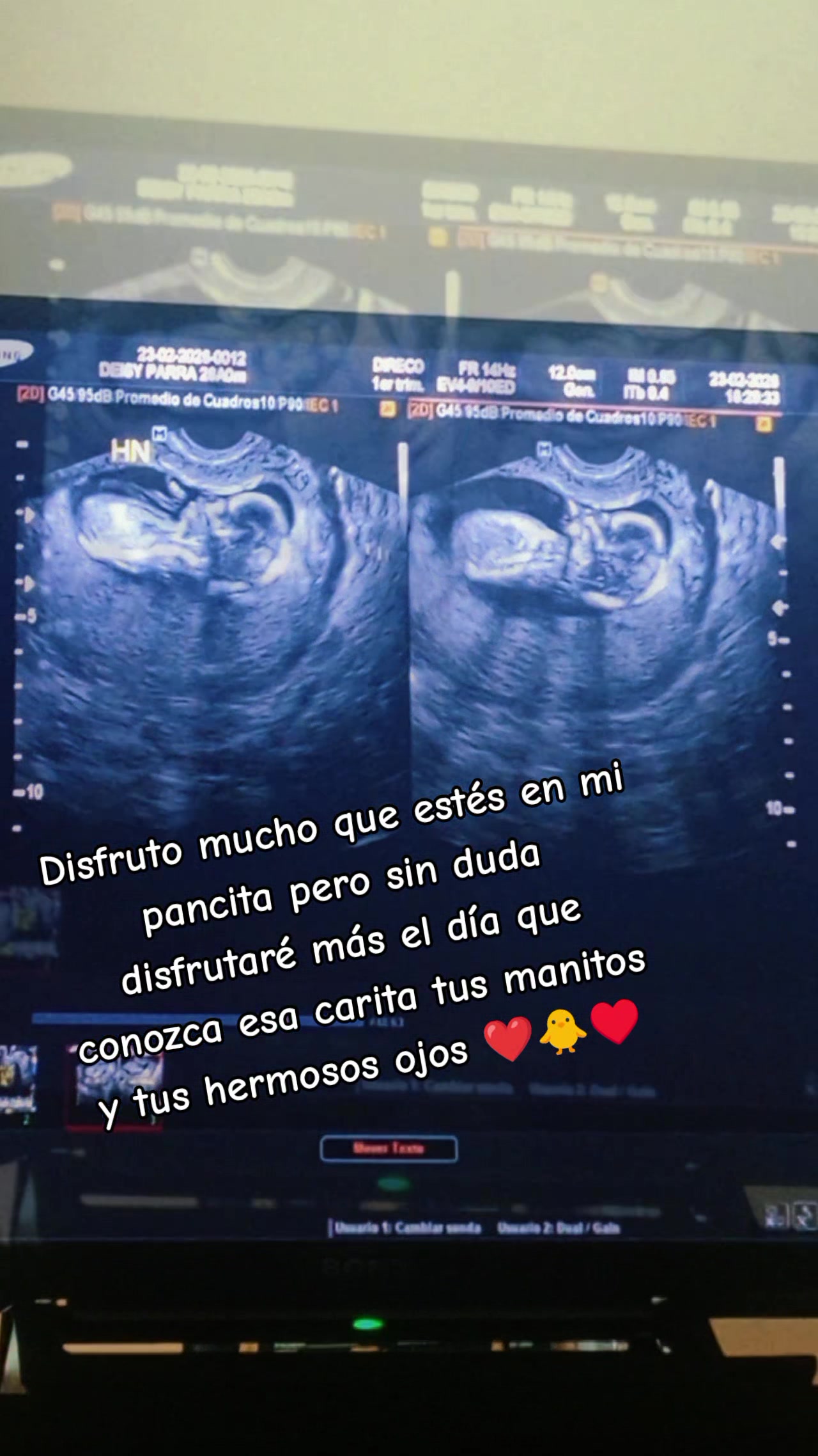 @Abi🌺❤️💋💅