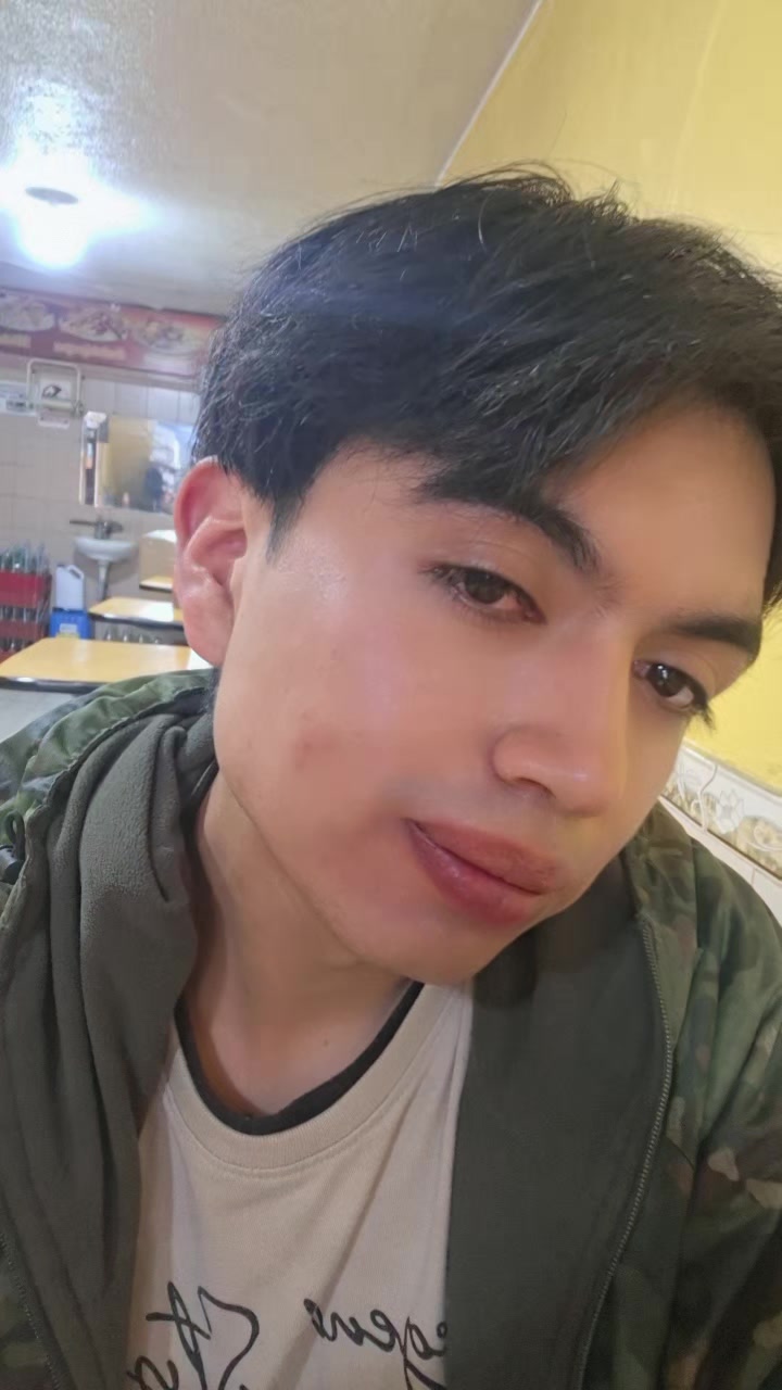 @Stiven Vasco ๐